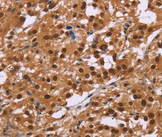 Anti-Human/Mouse/Rat CTNNBL1 Antibody
