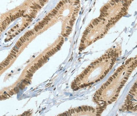 Anti-Human/Mouse ASH2L Antibody - ABMIUM