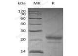 Recombinant Human Cystatin 7/CST7 Protein (His Tag) - ABMIUM