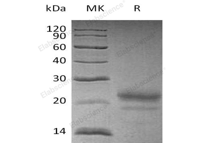 Recombinant Human Cystatin 7/CST7 Protein (His Tag) - ABMIUM