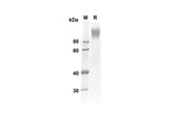 SDS-PAGE analysis of Human CD6 proteins, 2 μg/lane of Recombinant Human CD6 proteins was resolved with an SDS-PAGE under reducing conditions, showing bands at 67.2 kDa.