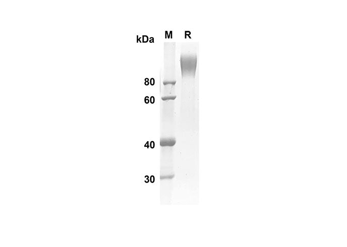 SDS-PAGE analysis of Human CD6 proteins, 2 μg/lane of Recombinant Human CD6 proteins was resolved with an SDS-PAGE under reducing conditions, showing bands at 67.2 kDa.