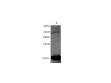 Anti-Human/Mouse/Rat GSTM1 Antibody - ABMIUM