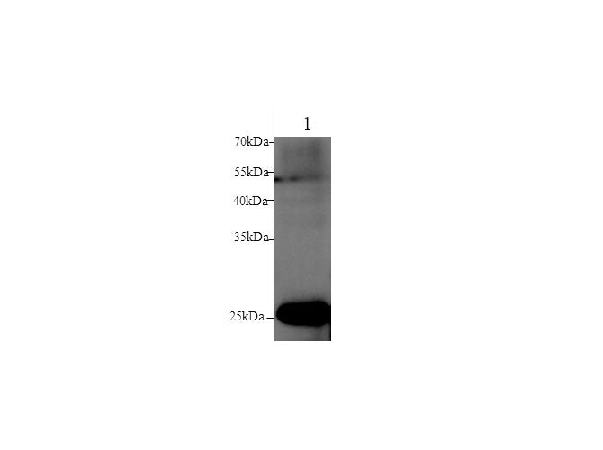 Anti-Human/Mouse/Rat GSTM1 Antibody - ABMIUM
