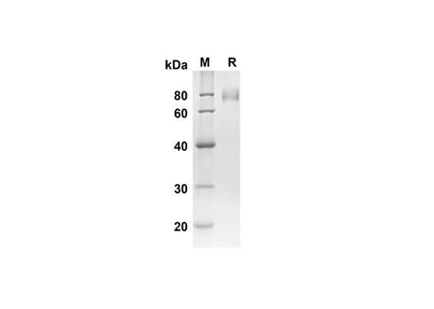 SDS-PAGE analysis of Human CRTAM proteins, 2 μg/lane of Recombinant Human CRTAM proteins was resolved with SDS-PAGE under reducing conditions, showing bands at 54.6 kDa.