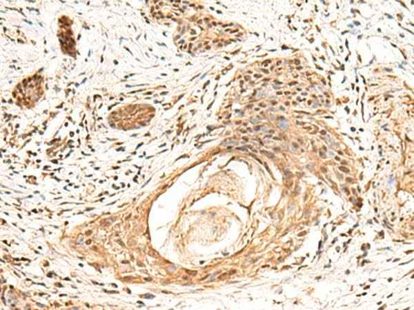 Anti-Human/Mouse KCTD13 Antibody
