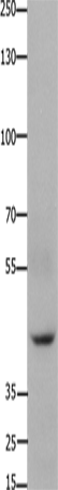 Anti-Human/Mouse FOXD3 Antibody - ABMIUM