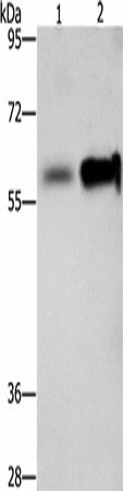 Western blot analysis of Hepg2 cells NIH/3T3 cells using ZBTB7A Polyclonal Antibody at dilution of 1:500