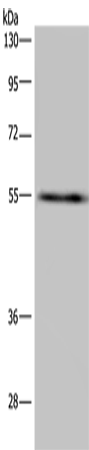 Anti-Human/Mouse/Rat IMPDH2 Antibody - ABMIUM
