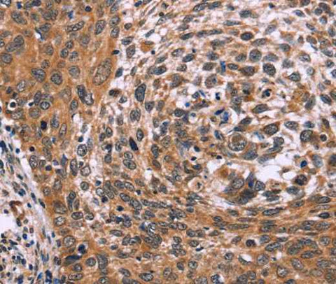 Anti-Human/Mouse ING2 Antibody