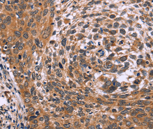Anti-Human/Mouse ING2 Antibody - ABMIUM
