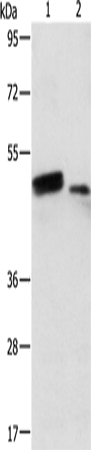 Anti-Human/Mouse RARB Antibody - ABMIUM