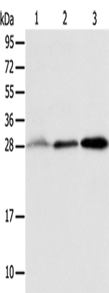 Anti-Human/Mouse ALKBH2 Antibody - ABMIUM