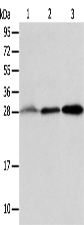 Anti-Human/Mouse ALKBH2 Antibody - ABMIUM