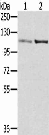 Anti-Human/Mouse/Rat SENP7 Antibody