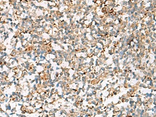 Immunohistochemistry of paraffin-embedded Human tonsil tissue using NPC2 Polyclonal Antibody at dilution of 1:50(×200)