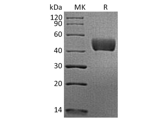 Recombinant Human Mesothelin/MSLN Protein (His & Avi Tag) - ABMIUM