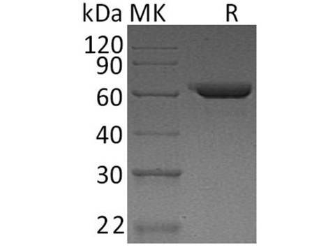 Recombinant Human Fibronectin/FN Protein - ABMIUM