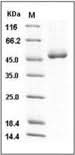 Recombinant Mouse Cathepsin D/CTSD Protein (His Tag) - ABMIUM