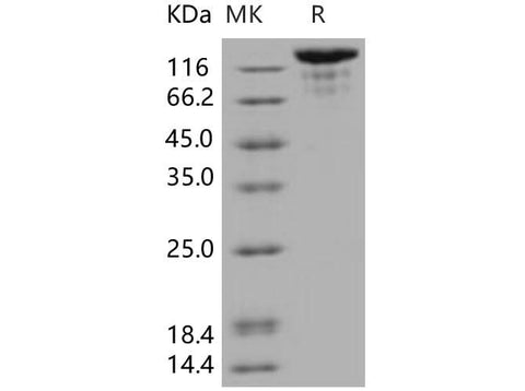 Recombinant Human VEGFR3/FLT4 Protein (Fc Tag) - ABMIUM