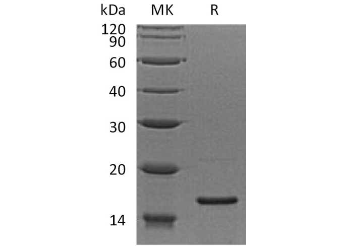 Recombinant Human RPS19 Protein - ABMIUM