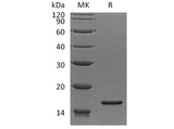 Recombinant Human RPS19 Protein - ABMIUM