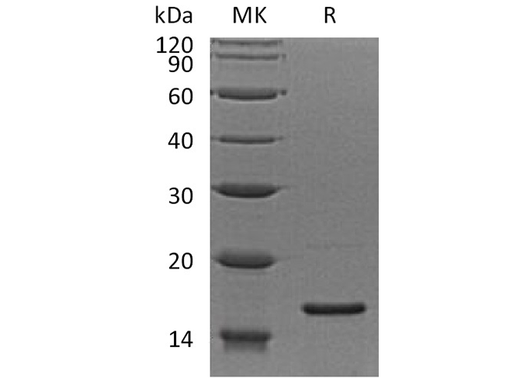 Recombinant Human RPS19 Protein - ABMIUM