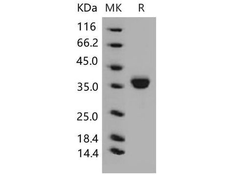> 95 % as determined by reducing SDS-PAGE.