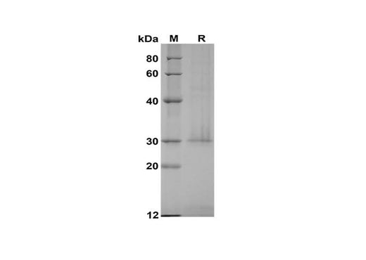 SDS-PAGE analysis of Human K-Ras proteins, 2 μg/lane of Recombinant Human K-Ras proteins was resolved with SDS-PAGE under reducing conditions, showing bands at 30 kDa.