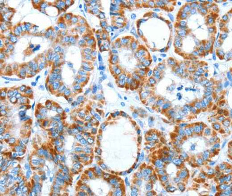 Anti-Human/Mouse/Rat ALDH5A1 Antibody