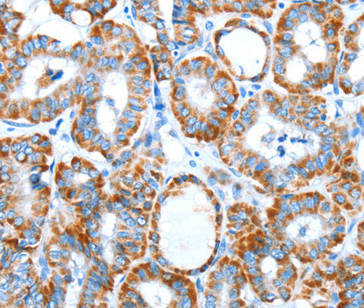 Anti-Human/Mouse/Rat ALDH5A1 Antibody - ABMIUM
