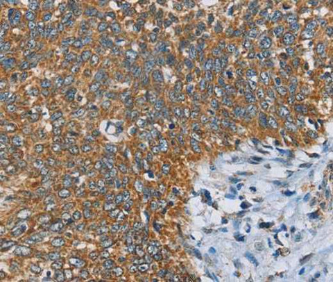 Anti-Human ANKHD1 Antibody