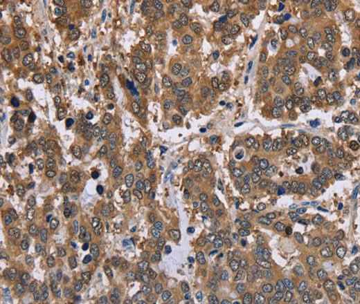 Anti-Human/Mouse/Rat FBP2 Antibody
