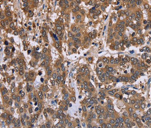 Anti-Human/Mouse/Rat FBP2 Antibody - ABMIUM