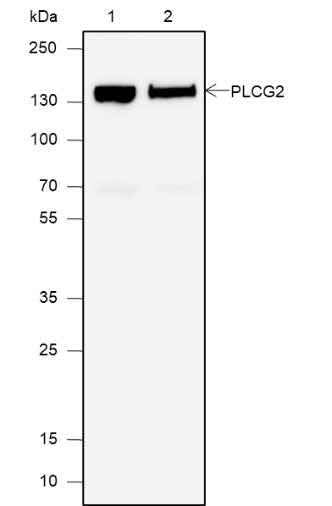 Anti-Human PLCG2 Antibody [A609] - ABMIUM
