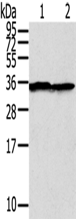 Anti-Human/Mouse/Rat STX3 Antibody - ABMIUM