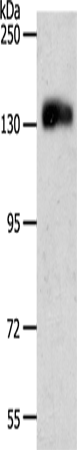 Anti-Human/Mouse CD31 Antibody - ABMIUM