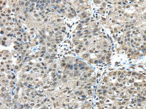 Anti-Human/Mouse FUS Antibody - ABMIUM