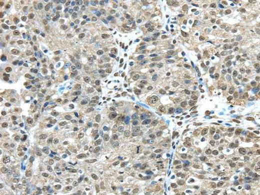 Anti-Human/Mouse FUS Antibody