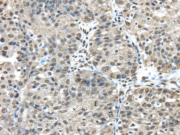 Anti-Human/Mouse FUS Antibody - ABMIUM