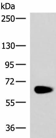 Western blot analysis of Human left kidney paracancerous tissue lysate using NOTCH4 Polyclonal Antibody at dilution of 1:800