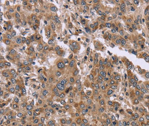 Anti-Human/Mouse FAM3B Antibody - ABMIUM