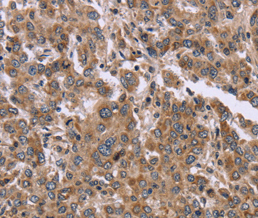 Anti-Human/Mouse FAM3B Antibody - ABMIUM