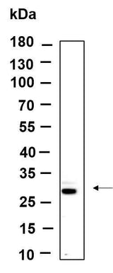 Anti-Human/Mouse/Rat FRAT1 Antibody [B988]