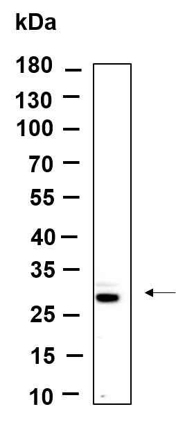 Anti-Human/Mouse/Rat FRAT1 Antibody [B988]