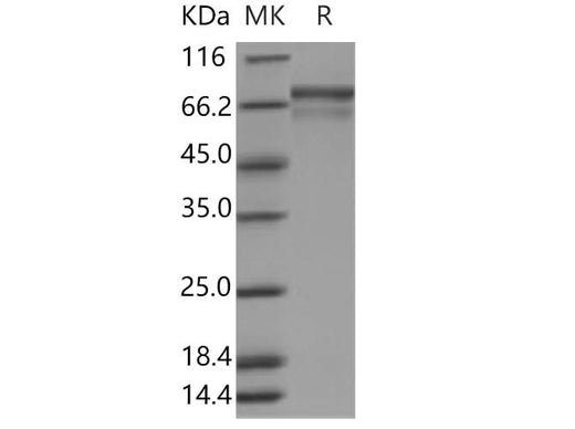 Recombinant Human PRC1 Protein (His Tag) - ABMIUM