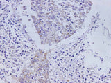 Anti-Human CEACAM1 Antibody - ABMIUM