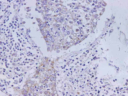 Anti-Human CEACAM1 Antibody