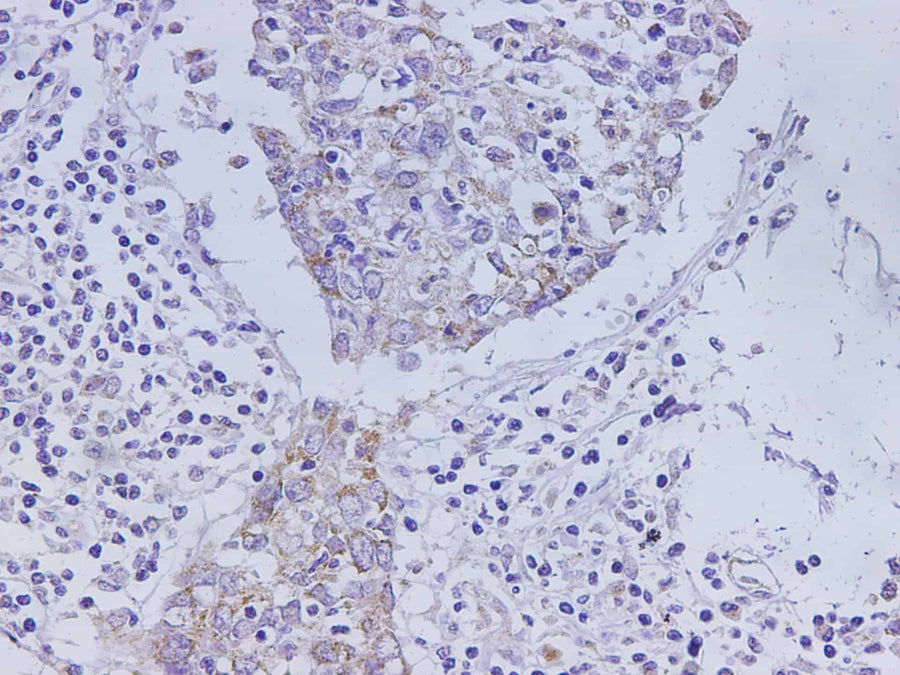 Anti-Human CEACAM1 Antibody - ABMIUM