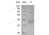 Recombinant Human CDK2AP2 Protein (Human Cells, His Tag) - ABMIUM